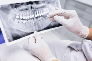 Curso gratuito de Básico em Endodontia