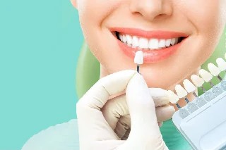 Curso gratuito de Básico em Facetas Diretas e Indiretas
