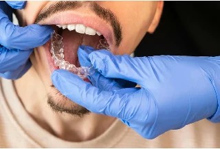 Curso gratuito de Básico em Odontologia Estética