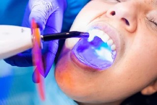 Curso gratuito de Básico em Resina Composta na Odontologia