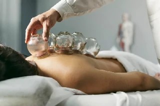 Curso gratuito de Ventosaterapia